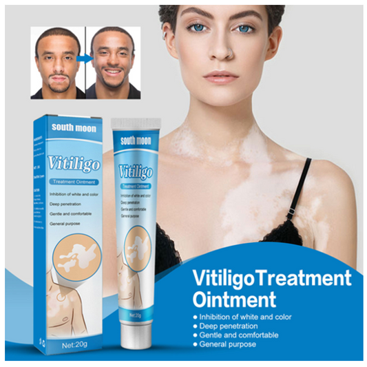 South Moon Vitiligo Treatment Cream