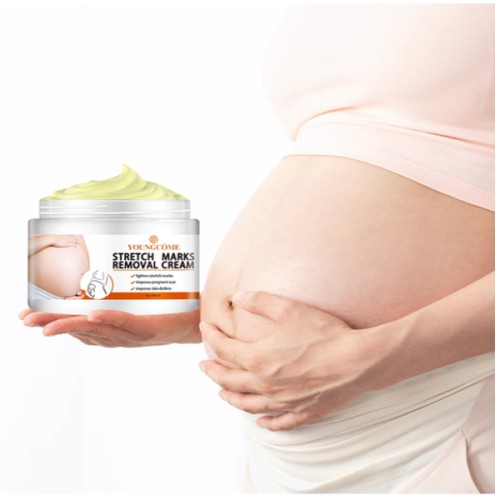 Youngcome Stretch Mark Removal Cream